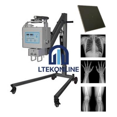 累积量pital Digital Portable X Ray Machine
